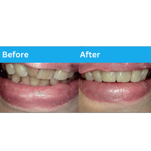 cosmetic dentistry before and after | dentist white bear lake