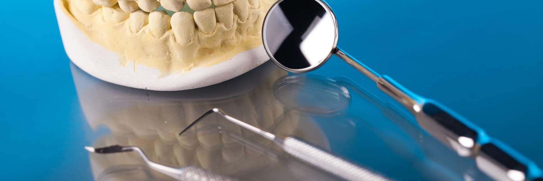 close up of mouth impression | white bear lake mn dentist