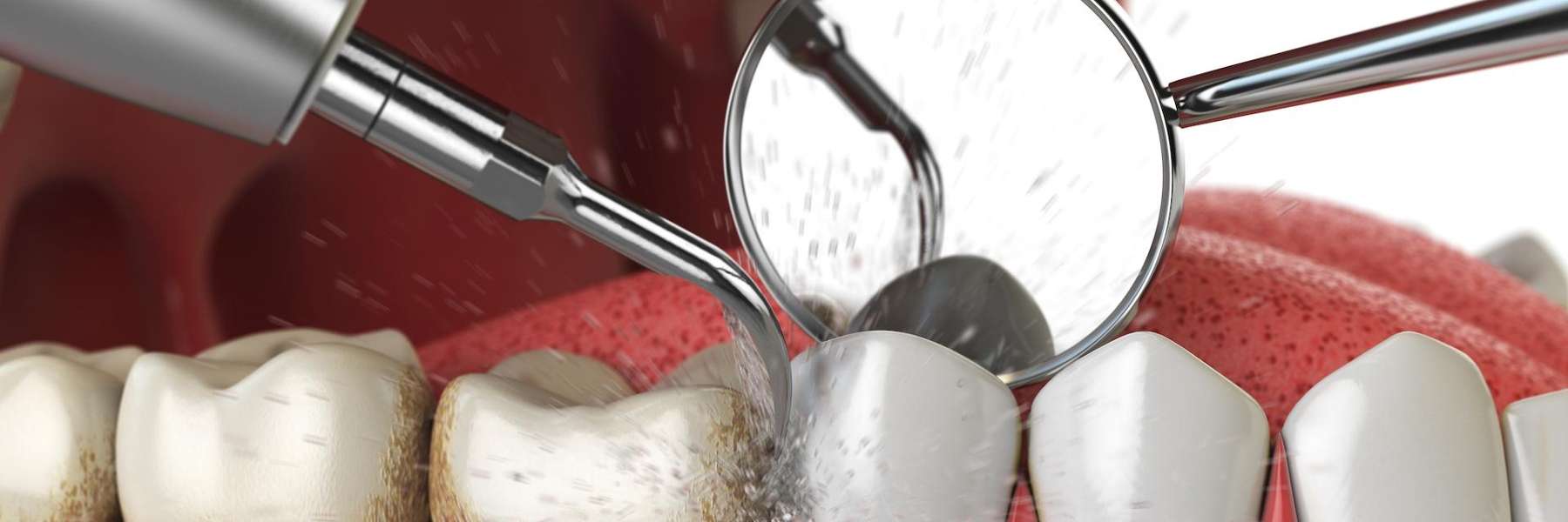 National Gum Care Awareness Month