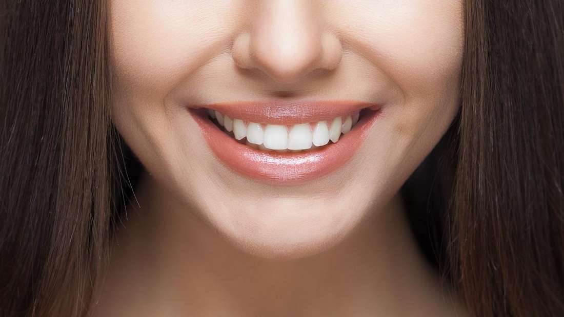 How Long Do Veneers Last? Cosmetic Dentistry White Bear Lake MN