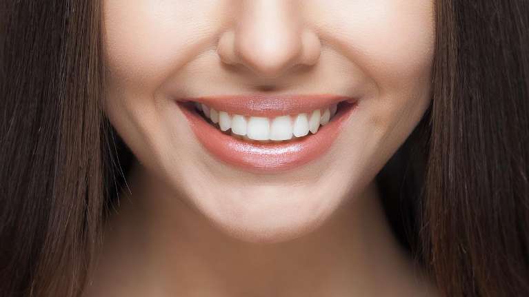 woman with bright smile | cosmetic dentist white bear lake mn