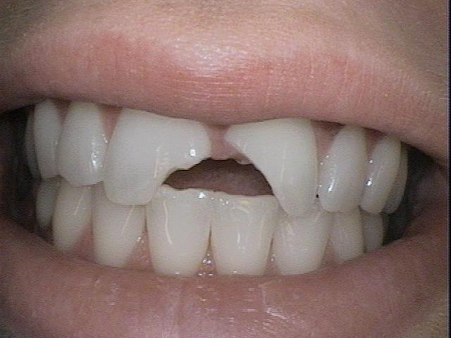 Emergency-Dentistry-Before-Image